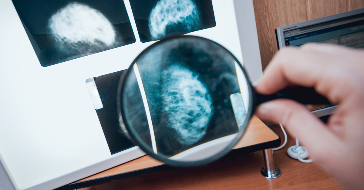 Profilaktyka raka piersi, Mammografia - co ile si bada?