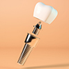 Zapomnij o problemach z uzbieniem: jak implanty zbw przywracaj pen funkcjonalno jamy ustnej
